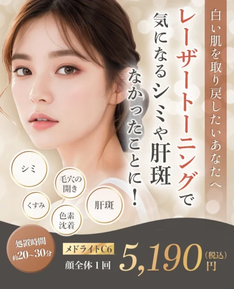 シミ取りレーザー治療