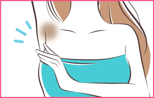 毛穴詰まり