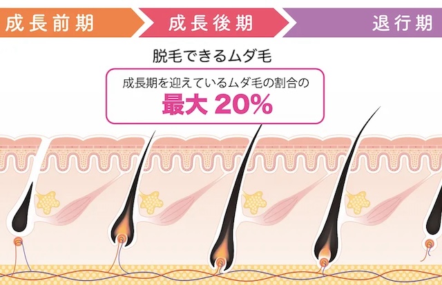脱毛_ムダ毛の割合