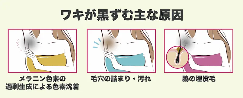わきの黒ずみ原因