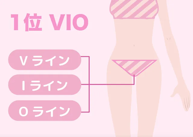 VIO脱毛1位