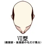 001-12-VII型