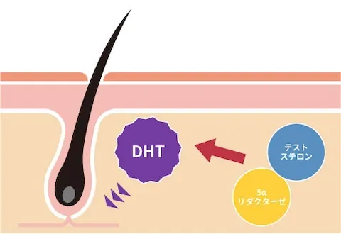 男性ホルモン「DHT」