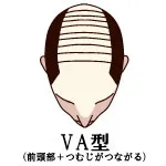 001-10-VA型