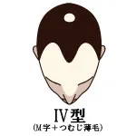 001-7-IV型