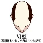 001-11-VI型