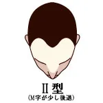 001-2-II型