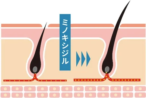 ミノキシジルの作用機序