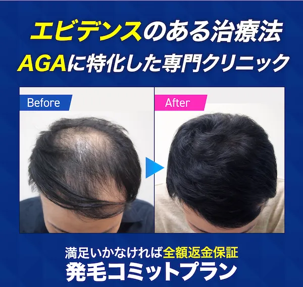 AGA_スキンクリニック