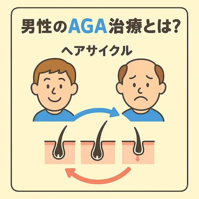 男性のAGA治療とは？